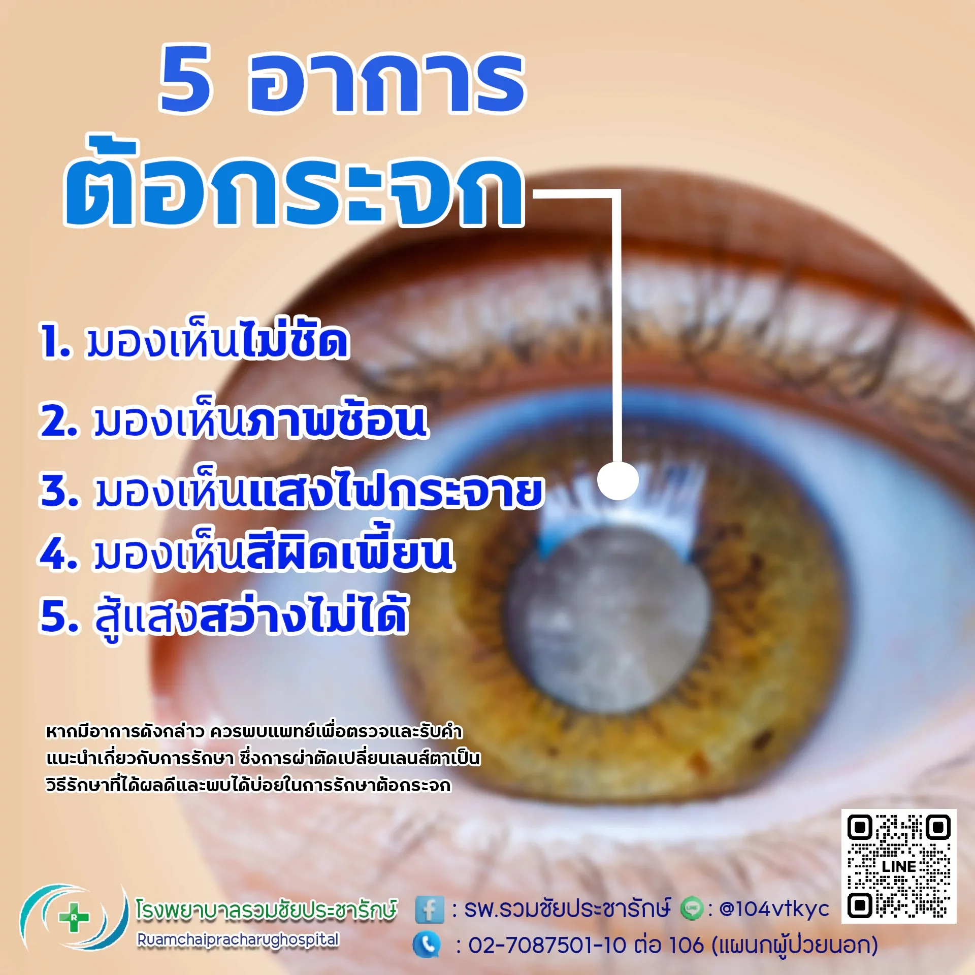 cataract5